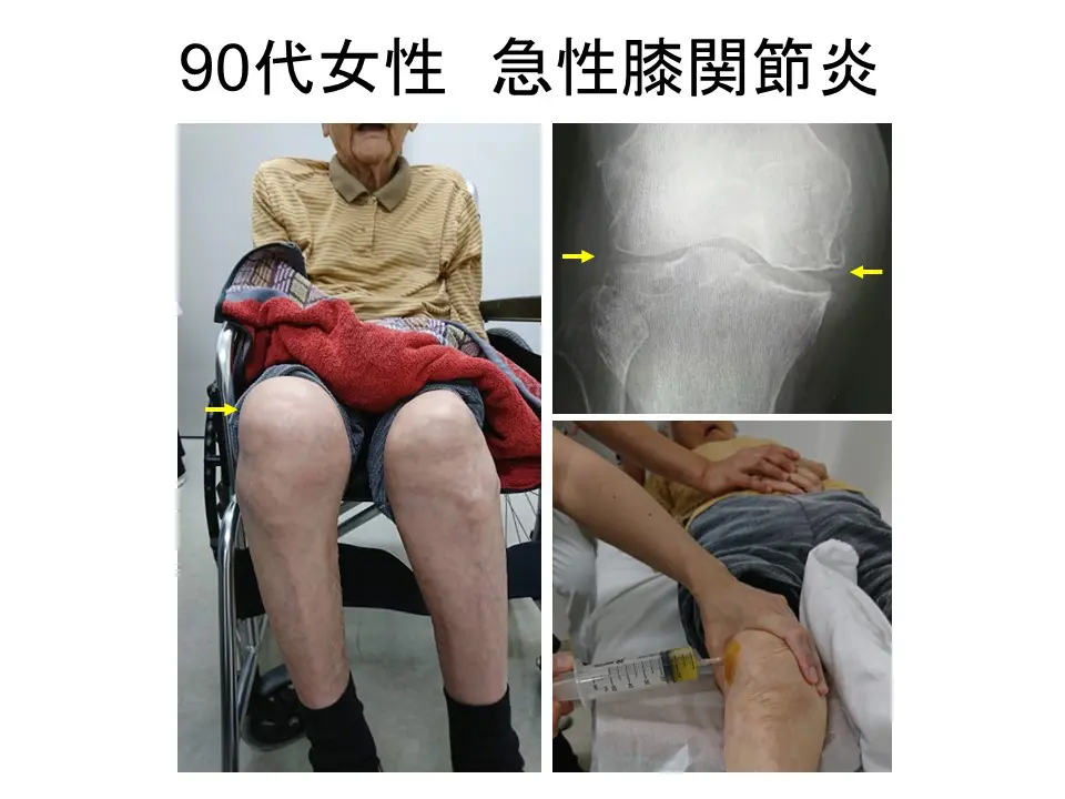 関節の痛み J.McMメンネル著 関節の痛み J.McMメンネル著 本